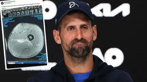 Djoković zwrócił się do "ekspertów"