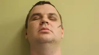 Obrażenia Dmytro Bułatowa