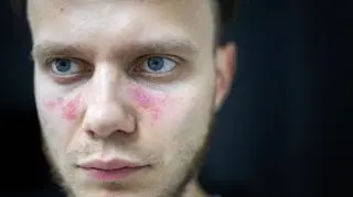 Powszechny wirus groźniejszy niż przypuszczano? Przełomowe odkrycie