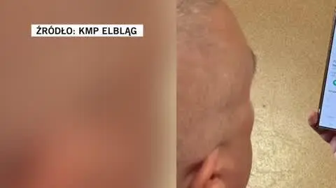 policja telefon cale