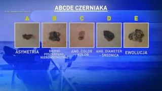 Abecadło czerniaka