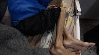 ONZ oświadczyła, że ​​Gaza jest jedynym terytorium na świecie, na którym cała populacja jest zagrożona głodem