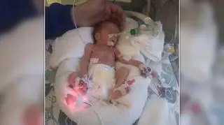 Była "maleńka jak ręka". Gdy szczęście rodziców miesza się ze strachem