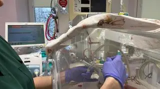 Pierwsze takie wcześniaki w Polsce. Lekarze zastosowali specjalny wzmacniacz mleka matki