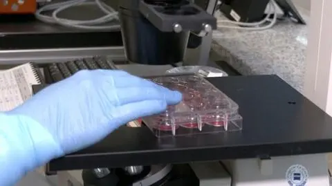 WHO wydało rekomendacje w sprawie małpiej ospy