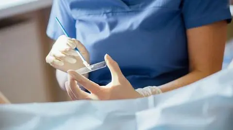 Narodowy Instytut Onkologii: tylko 14 procent kobiet zrobiło cytologię w czasie pandemii
