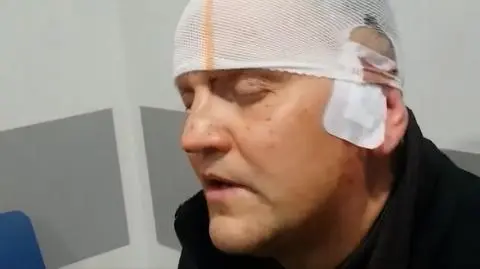 Bójka skłóconych księży salezjanów w Poznaniu. Jeden z nich trafił do szpitala z rozbitą głową