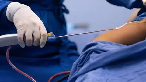Poddała się zabiegowi odsysania tłuszczu i podnoszenia pośladków. Po liposukcji kobieta zmarła