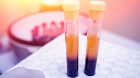 probowki shutterstock_617777957