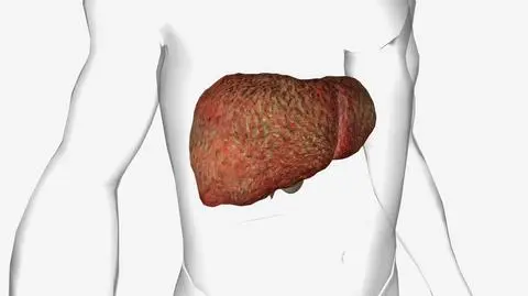 pbc watroba choroba shutterstock_2317247939