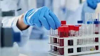 Badania genetyczne BRCA1 i BRCA2 teraz w ambulatorium