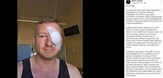 Pan Marcin ma uszkodzone oko
