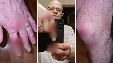 Dzik pogonił radnego. Skończyło się w szpitalu