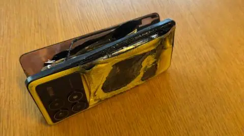 Telefon wybuchł w rękach 16-latka