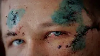 10 dni, które trwają cztery lata. Tak wygląda wojna