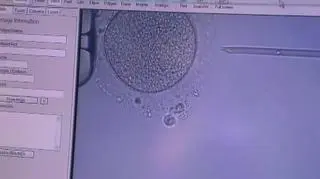 Szósta edycja miejskiego programu dofinansowania zabiegów in vitro w Łodzi