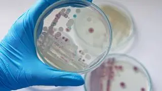 Vibrio vulnificus, kultura laboratoryjna