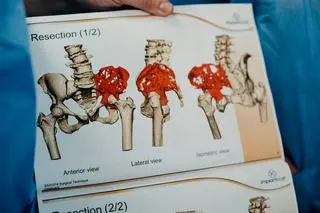 Czerwonym kolorem zaznaczono miejsca zmienione nowotworowo