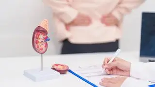 Liczba zachorowań na raka nerki wzrośnie dwukrotnie