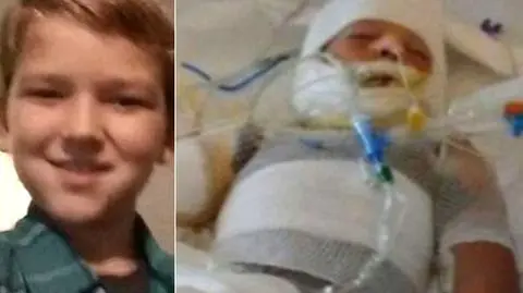 Podpalenie przez rówieśnika czy nieszczęśliwy wypadek? 10-latek z Teksasu walczy o życie