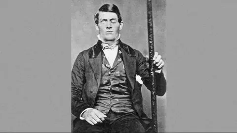Phineas Gage