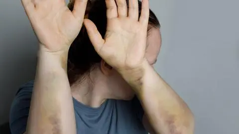 Każdego roku w Polsce z powodu przemocy domowej ginie około pół tysiąca kobiet 