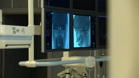 "Przestała mówić, pojawił się niedowład". Lekarze uratowali 16-latkę z udarem