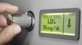 Nowe światło rzucone na cholesterol. Sterowanie zamiast obniżania