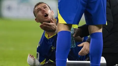 Edin Dżeko pokazał obrażenia po ciosie