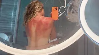 Szokujące zdjęcie tenisistki. "To nie żart"