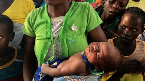 Mozambik: prawie 1500 przypadków zachorowań na cholerę