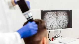 Kosmyk, który zdradza poważną chorobę. Naukowcy odkrywają nową metodę diagnostyczną