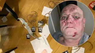 "Byłem torturowany, bałem się o życie". Oferuje 100 tysięcy złotych za wskazanie sprawców napadu