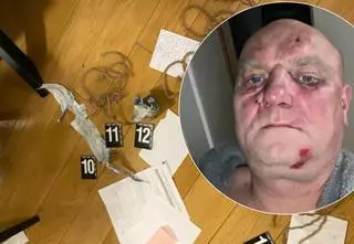 "Byłem torturowany, bałem się o życie". Oferuje 100 tysięcy złotych za wskazanie sprawców napadu