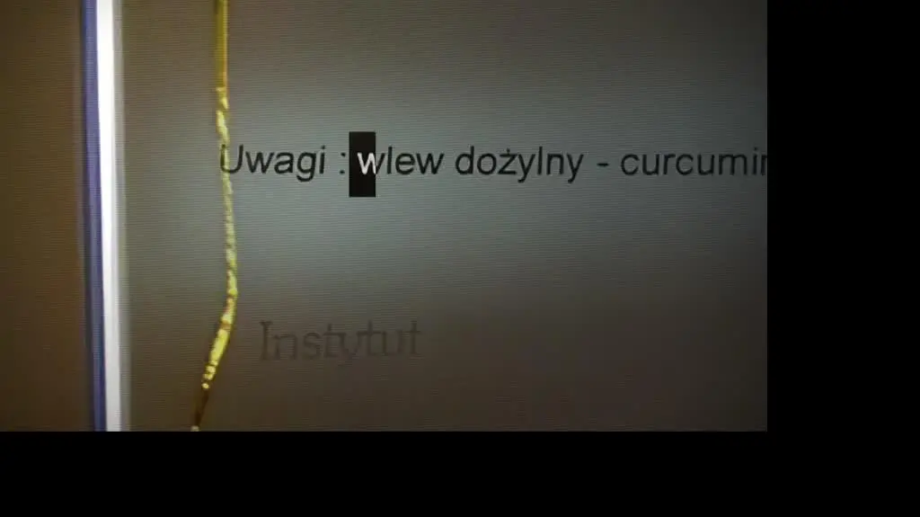 superwizjer kawalek