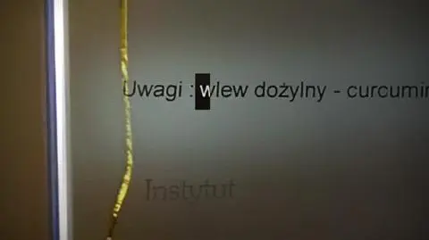 superwizjer kawalek
