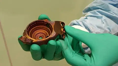 Wszczepili pacjentce protezę stawu biodrowego z drukarki 3D