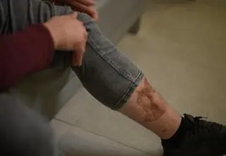 "O tym zapominamy", a "większości przypadków można uniknąć"