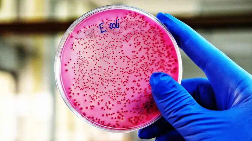 Niezwykłe odkrycie. Pasożyty jelitowe były obecne już tysiąc lat temu