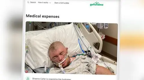 Został użądlony 20 tysięcy razy, 30 owadów połknął. Dwudziestolatek przeżył atak "pszczół zabójców" 