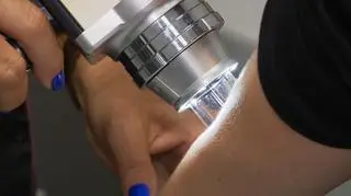 Coraz więcej przypadków czerniaka. Co jest najważniejsze w profilaktyce?