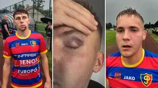 Bitwa na boisku. Piłkarze pobici przez pseudokibiców