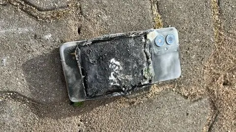 Pacjent rzucił telefonem, który się zapalił