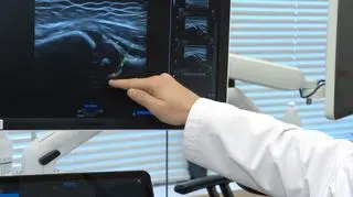 AI może pomóc w diagnostyce z wykorzystaniem USG