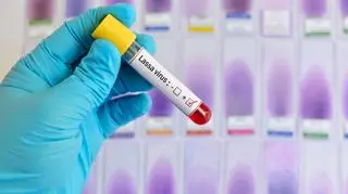 Walczą z epidemią gorączki Lassa. Już 127 ofiar śmiertelnych