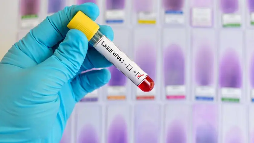 Walczą z epidemią gorączki Lassa. Już 127 ofiar śmiertelnych