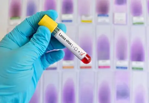Walczą z epidemią gorączki Lassa. Już 127 ofiar śmiertelnych