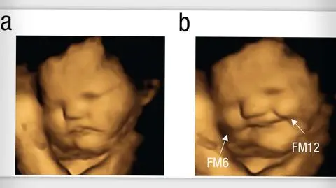 fig2