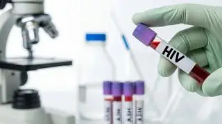 Po wecie prezydenta rząd wraca do przepisów o HIV i WZW C