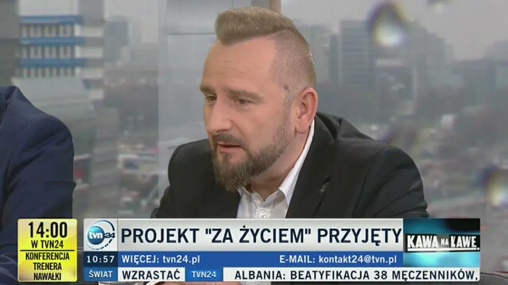 Liroy-Marzec (Kukiz&#039;15): niepełnosprawni potrzebują większego wsparcia niż daje "Za życiem"